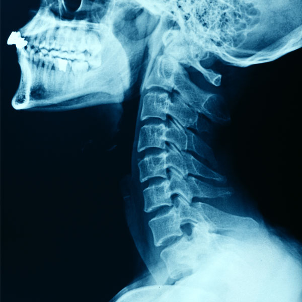 Lynnwood Chiropractor Same Day Appointments Hagen Chiropractic Center